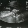 Baby B Wedin Profile